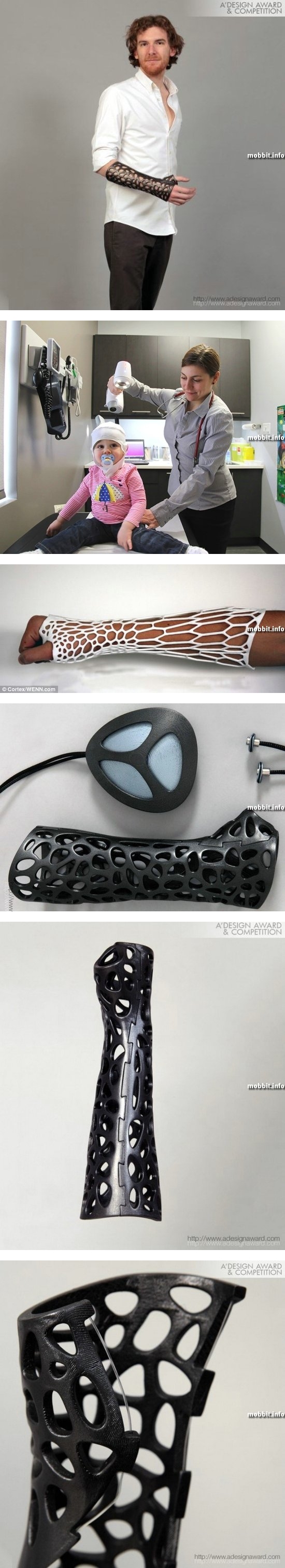 Osteoid Medical Cast